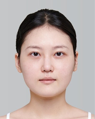 Before Image