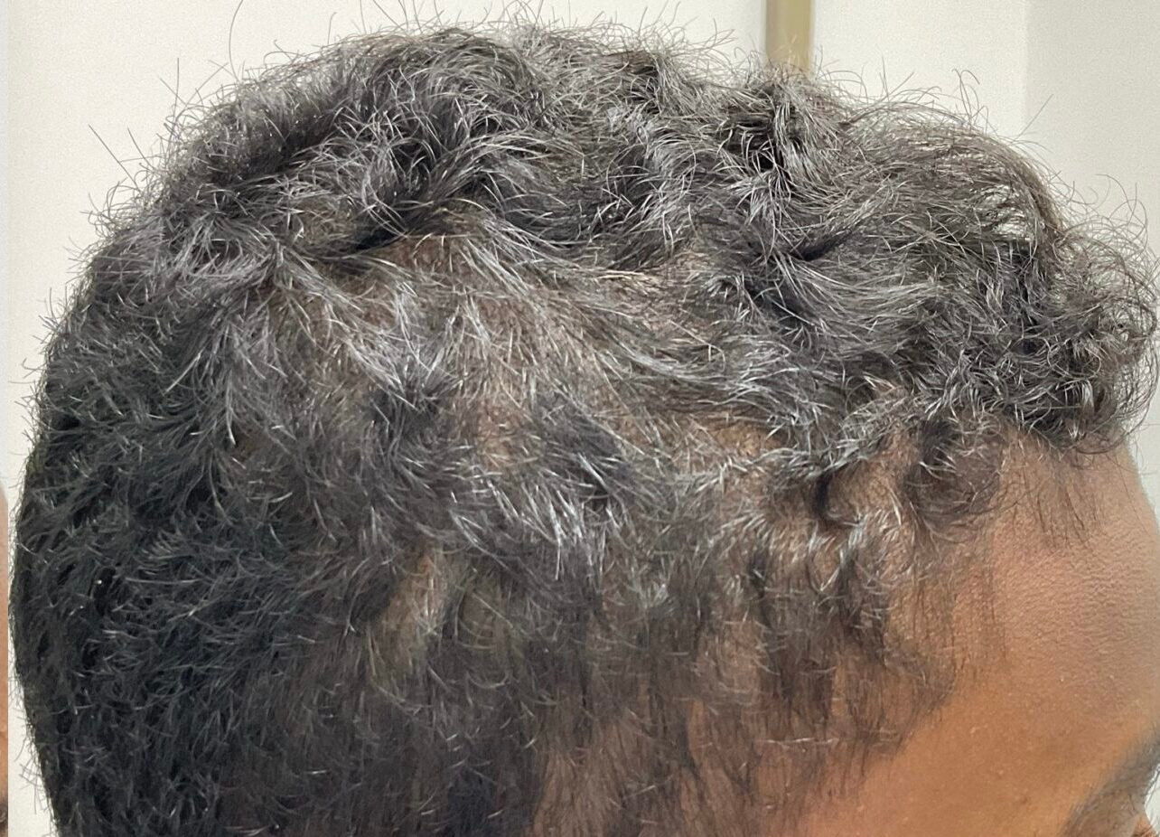 After